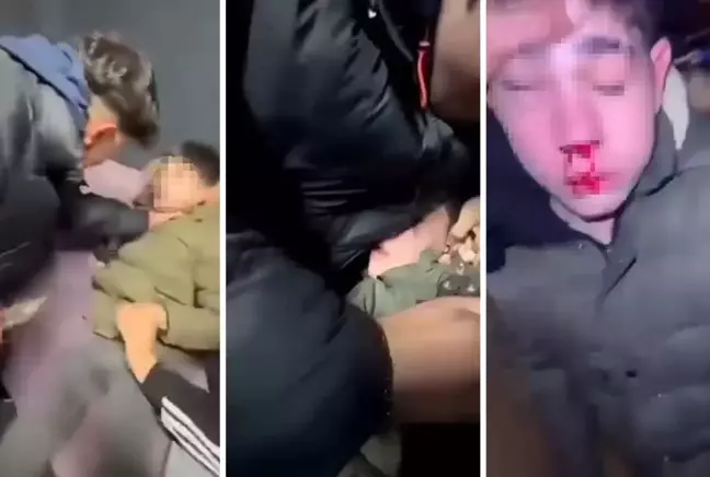 Çocuk Üzerinde Şiddet ve Kulağını Kesmeye Çalıştılar