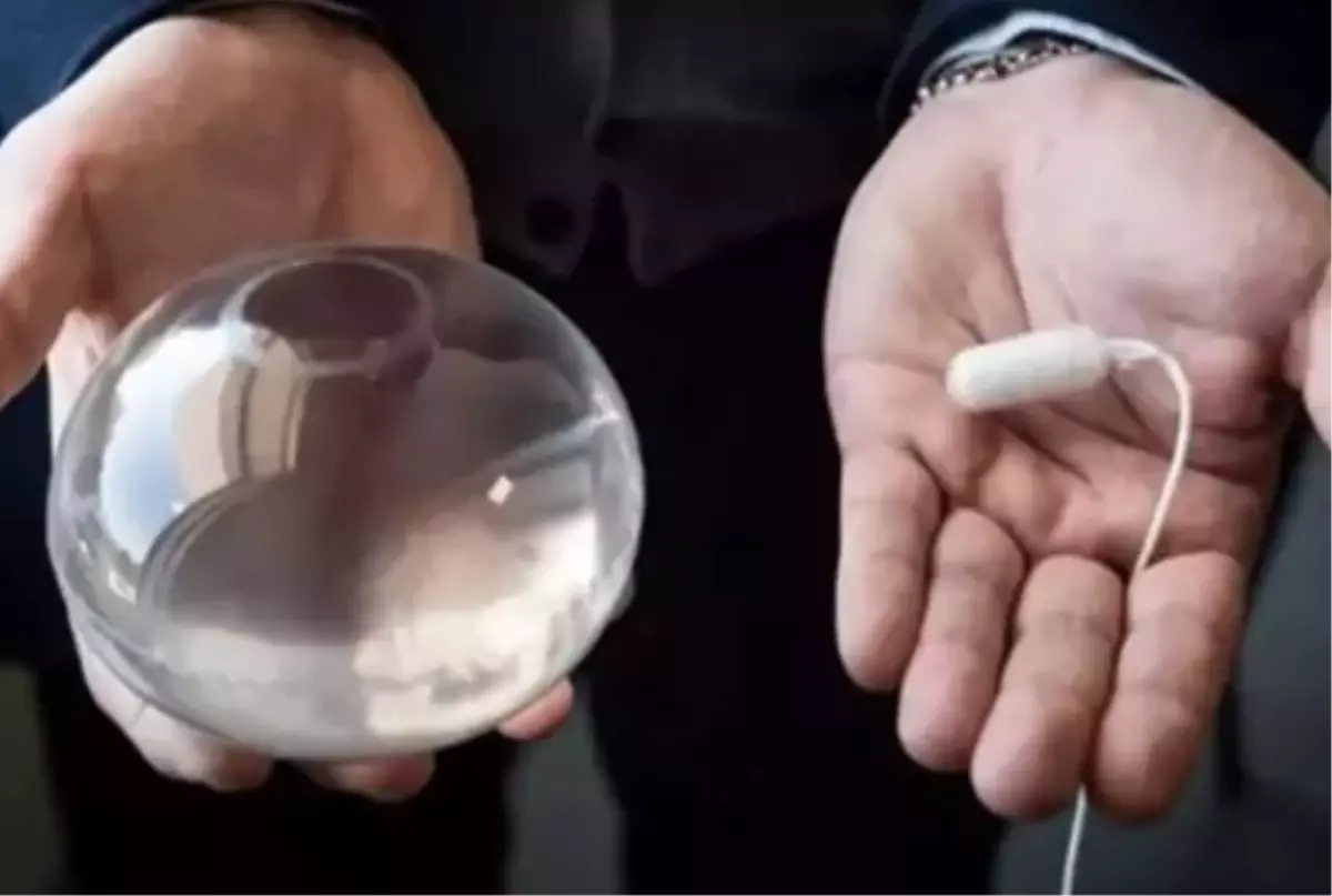 Sağlık Bakanlığı'ndan Mide Balonu Uyarısı ve Güncel Durum