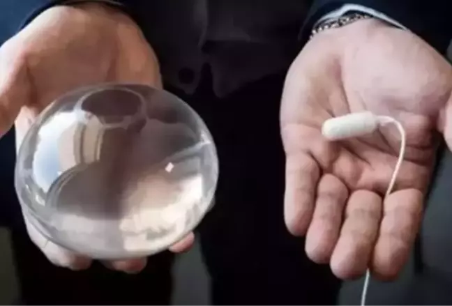 Mide Balonu Ameliyatı Yasaklandı mı?