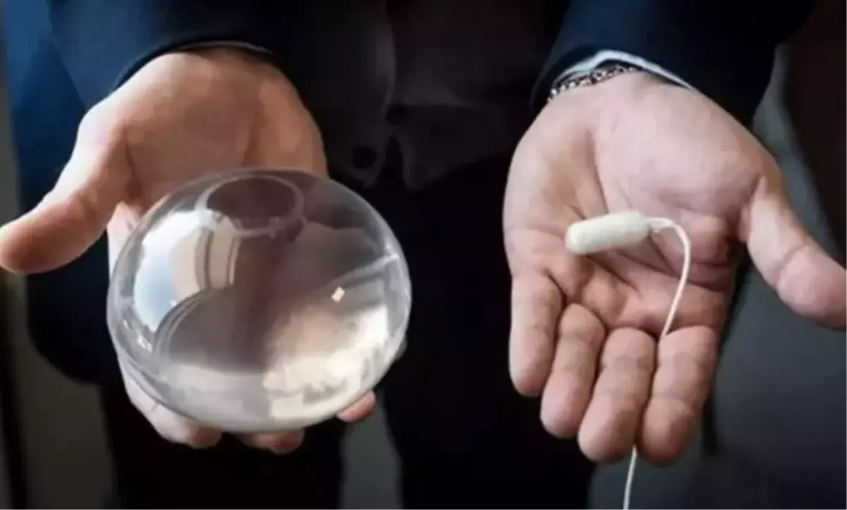 Mide Balonu Yasaklandı mı? Detaylar ve Güncel Durum
